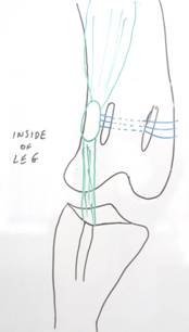Knee Cap”) Luxation (Dislocation)